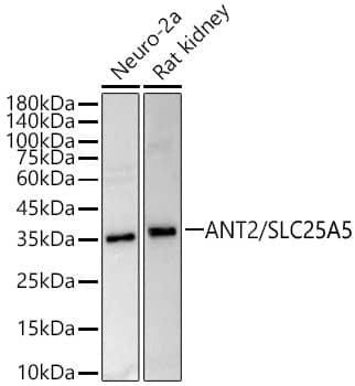 Adenine Nucleotide Translocator 2 Antibody - Azide and BSA Free