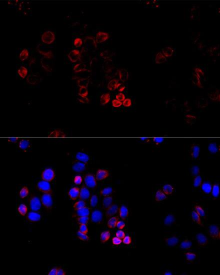 ABCG8 Antibody - BSA Free