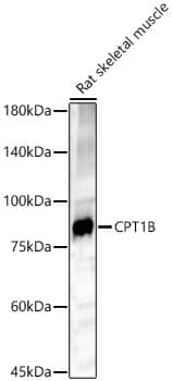 CPT1B Antibody - BSA Free