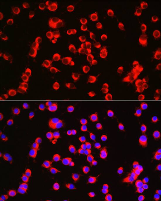 Catenin alpha 2 Antibody - Azide and BSA Free
