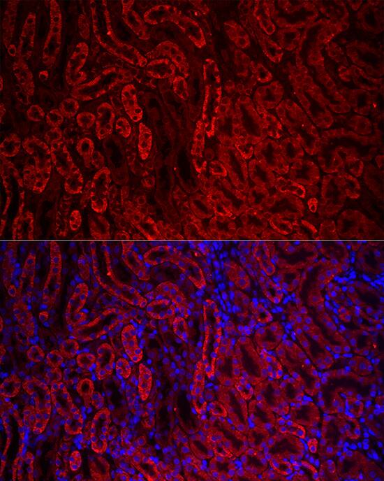 ACSL1 Antibody - Azide and BSA Free