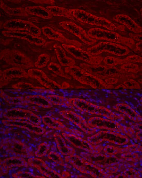 ACSL1 Antibody - Azide and BSA Free