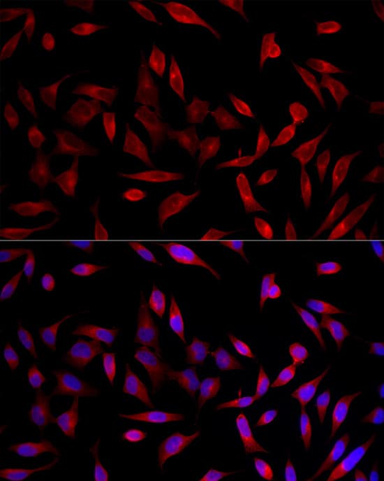 ACSL1 Antibody - Azide and BSA Free