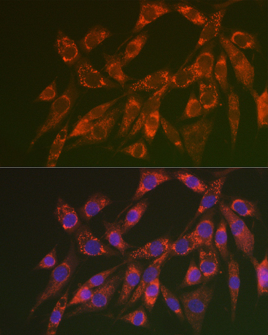 CHMP4B Antibody - BSA Free