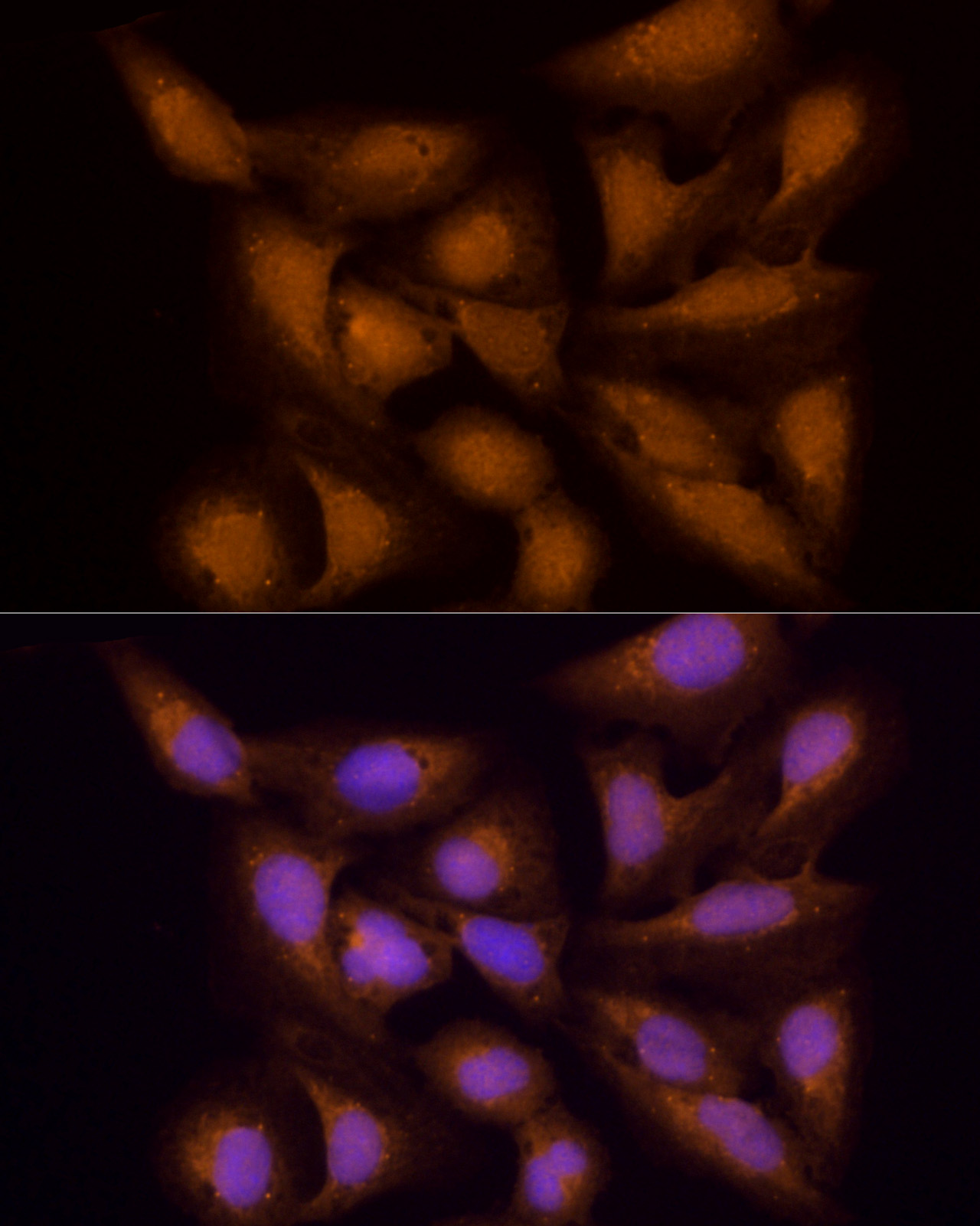 ECSIT Antibody - BSA Free