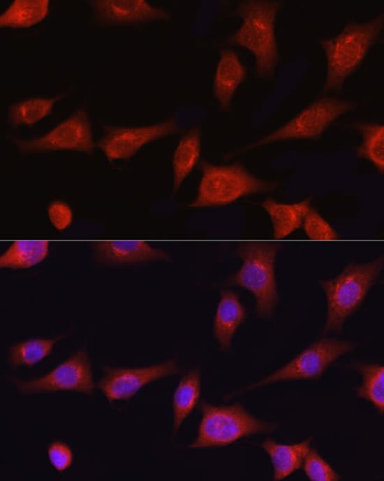 Collagen I alpha 1 Antibody - Azide and BSA Free
