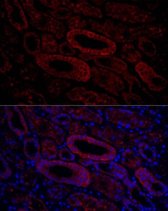 Aquaporin-3 Antibody - Azide and BSA Free