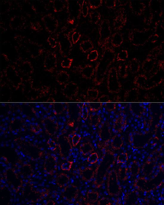 Aquaporin-3 Antibody - Azide and BSA Free