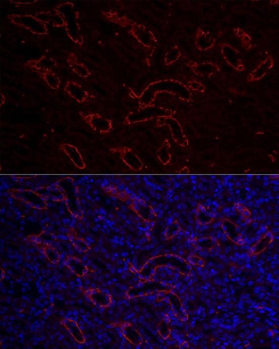 Aquaporin-3 Antibody - Azide and BSA Free