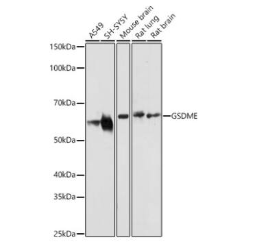 Dfna5 Antibody - Azide and BSA Free