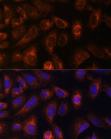 CAD Antibody - BSA Free