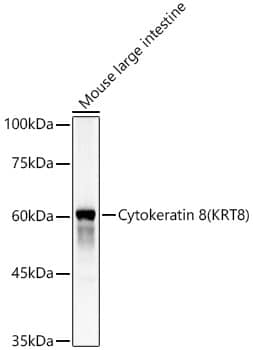 Cytokeratin 8 Antibody - Azide and BSA Free