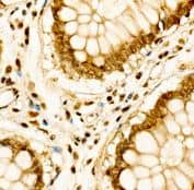 Cdk6 Antibody - Azide and BSA Free