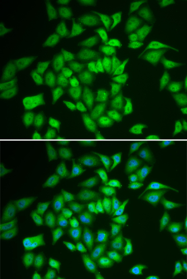 Casein Kinase 1 epsilon Antibody - BSA Free