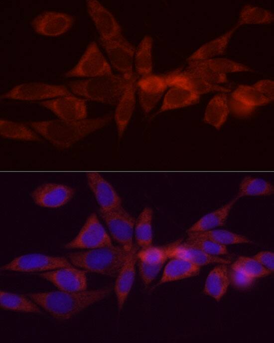 DGAT1 Antibody - BSA Free