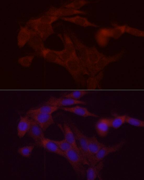 DGAT1 Antibody - BSA Free