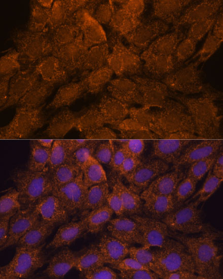 TNFAIP8L2 Antibody - Azide and BSA Free