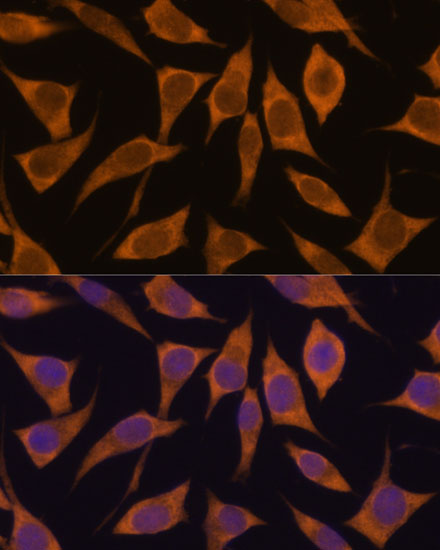 MRPL34 Antibody - Azide and BSA Free