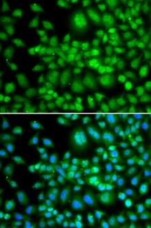 SETD5 Antibody - Azide and BSA Free