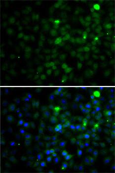 SMYD4 Antibody - BSA Free