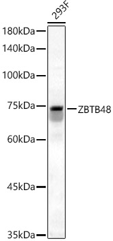 ZBTB48 Antibody - BSA Free