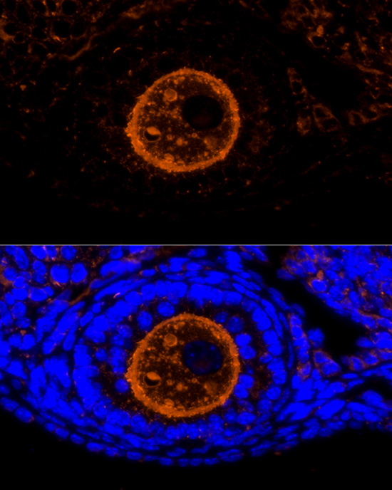 ZP2 Antibody - BSA Free