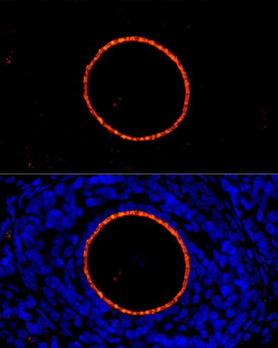ZP2 Antibody - BSA Free