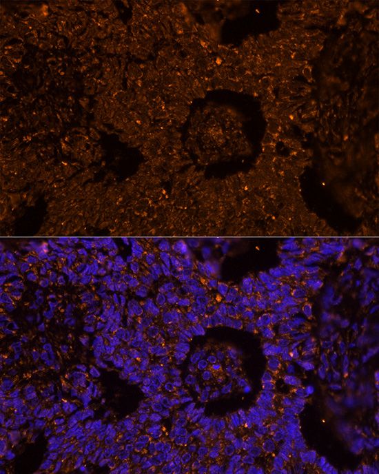 ZP2 Antibody - BSA Free
