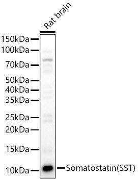 Somatostatin Antibody - Azide and BSA Free