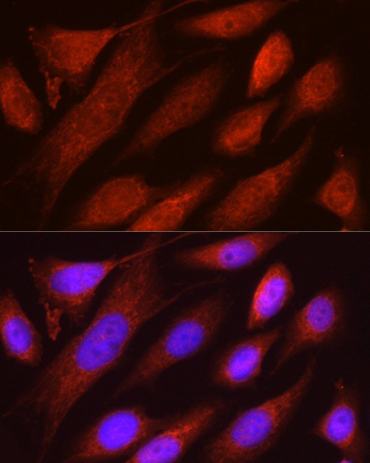 RHOT2 Antibody - Azide and BSA Free