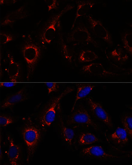 ZNF179 Antibody - Azide and BSA Free