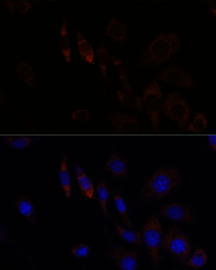ZNF179 Antibody - Azide and BSA Free