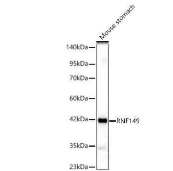 RNF149 Antibody - Azide and BSA Free