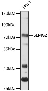 Semenogelin II Antibody - Azide and BSA Free