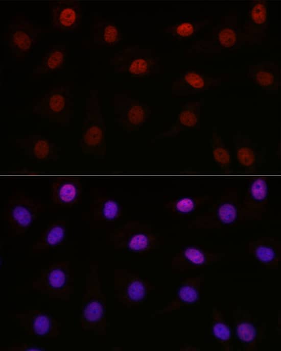 SETD8 Antibody - BSA Free