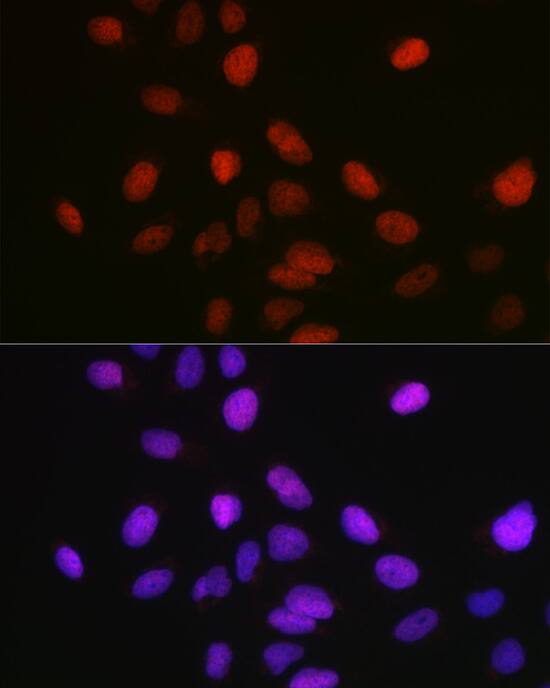 SETD8 Antibody - BSA Free