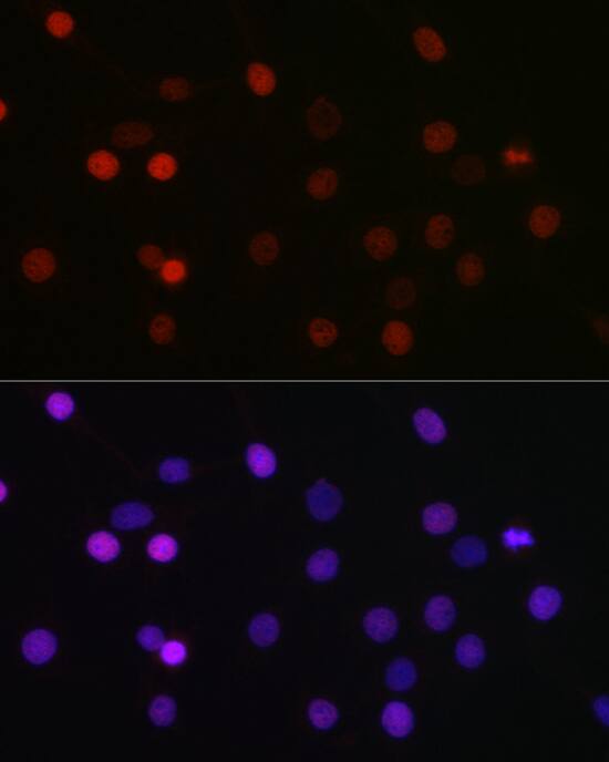SETD8 Antibody - BSA Free