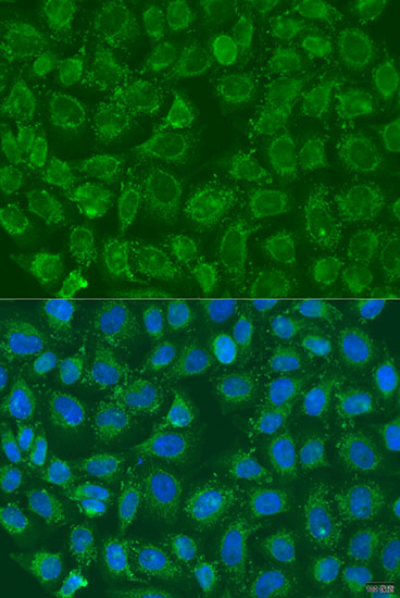 MSS4 Antibody - BSA Free