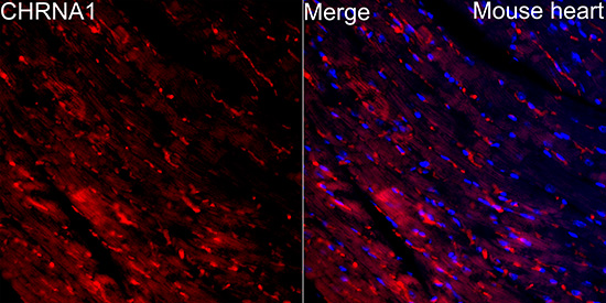 Nicotinic Acetylcholine R alpha 1/CHRNA1 Antibody - BSA Free
