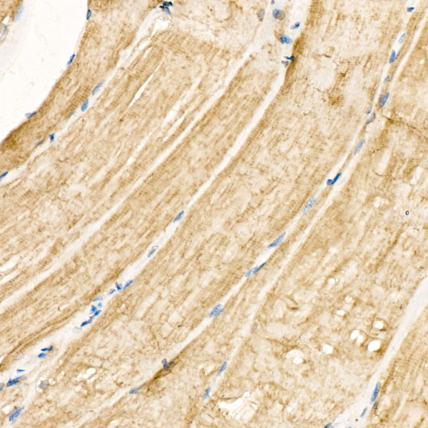 Nicotinic Acetylcholine R alpha 1/CHRNA1 Antibody - BSA Free