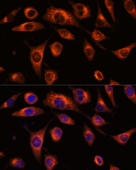 SCAMP2 Antibody - Azide and BSA Free