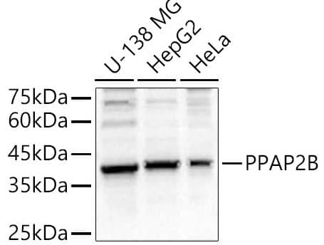 PPAP2B Antibody