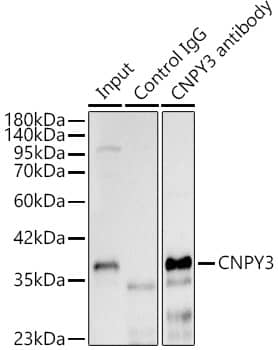 PRAT4A/TNRC5 Antibody - BSA Free