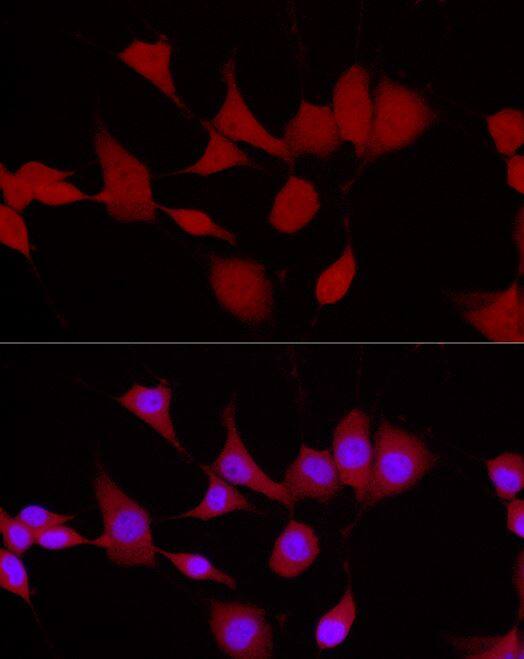 UCH-L5/UCH37 Antibody