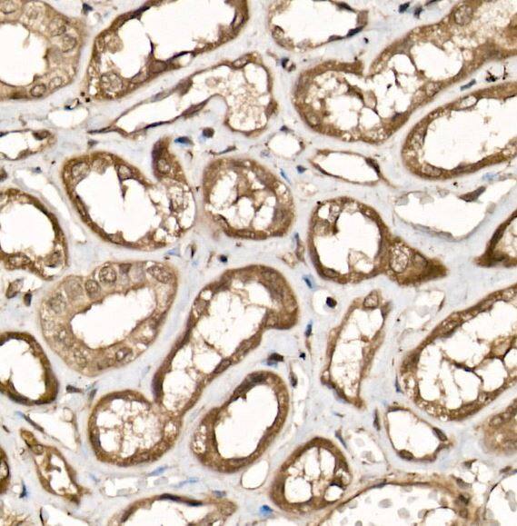 UCH-L5/UCH37 Antibody