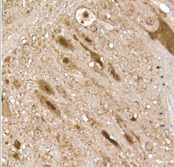 UCH-L5/UCH37 Antibody