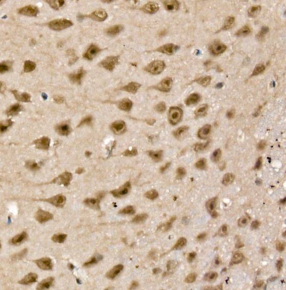 UCH-L5/UCH37 Antibody