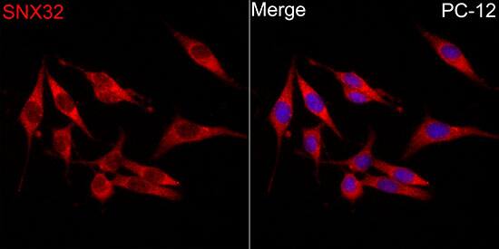 Sorting Nexin 32 Antibody - BSA Free