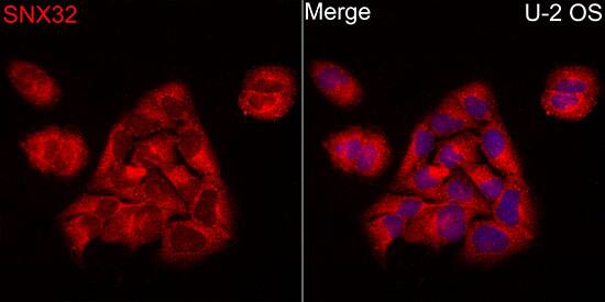 Sorting Nexin 32 Antibody - BSA Free