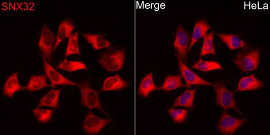 Sorting Nexin 32 Antibody - BSA Free